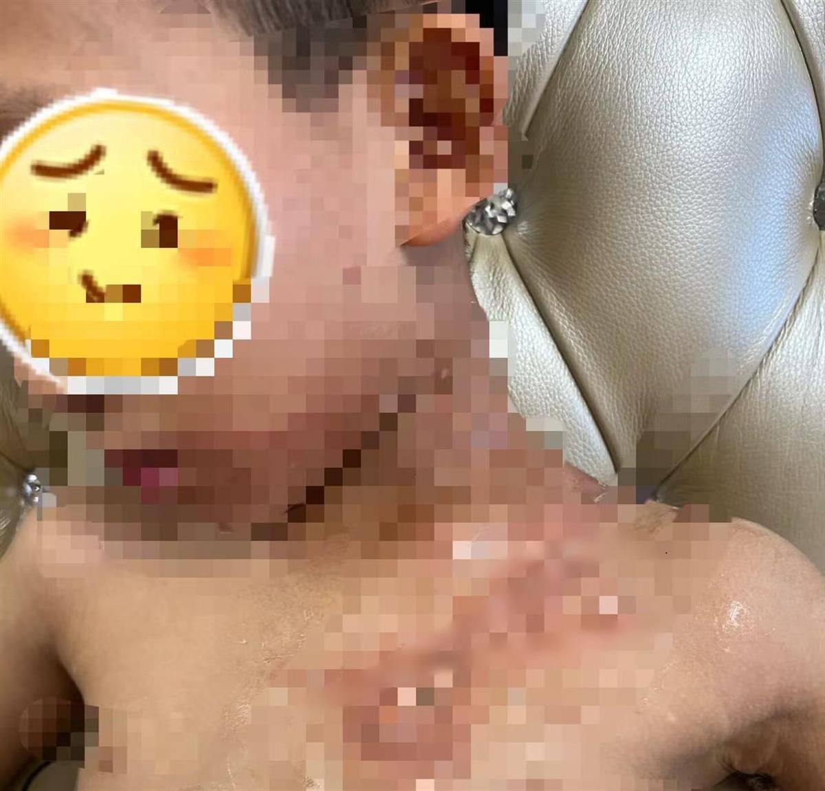 餐厅服务员端着酸菜鱼“追尾”撞上男孩,致其被热汤烫伤胸口,合肥警方介入