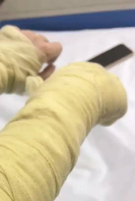 女主播称遭伪装快递包裹炸伤,湖南警方通报